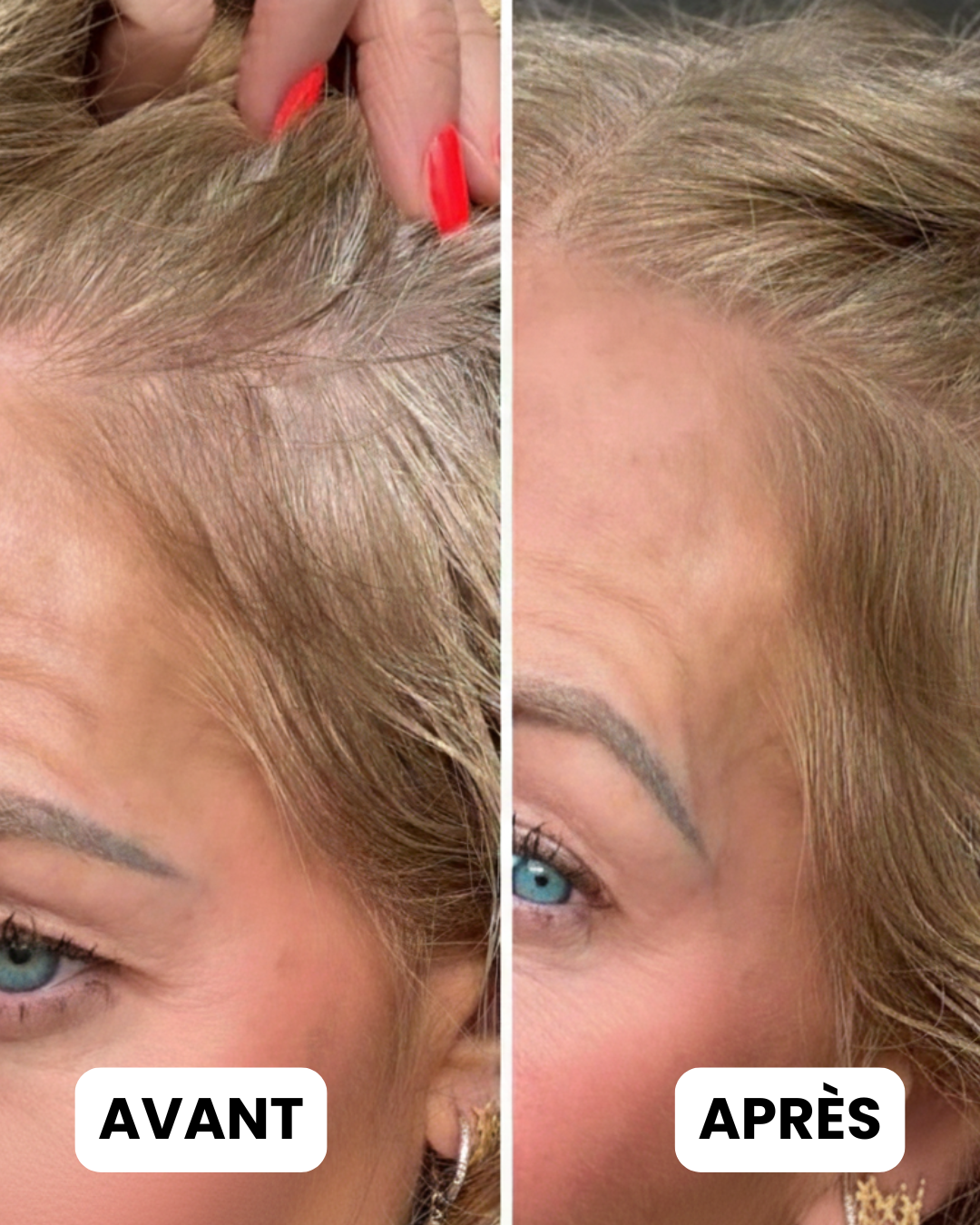 Poudre Magique Bellesera Pour Racines Blanches